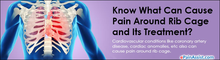 Know What Can Cause Pain Around Rib Cage And Its Treatment