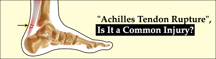 Is Achilles Tendon Rupture a Common Injury|Causes, Symptoms, Treatment