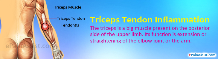 Triceps Tendon Inflammation or Strain|Symptoms|Causes|Treatment-Ultrasound