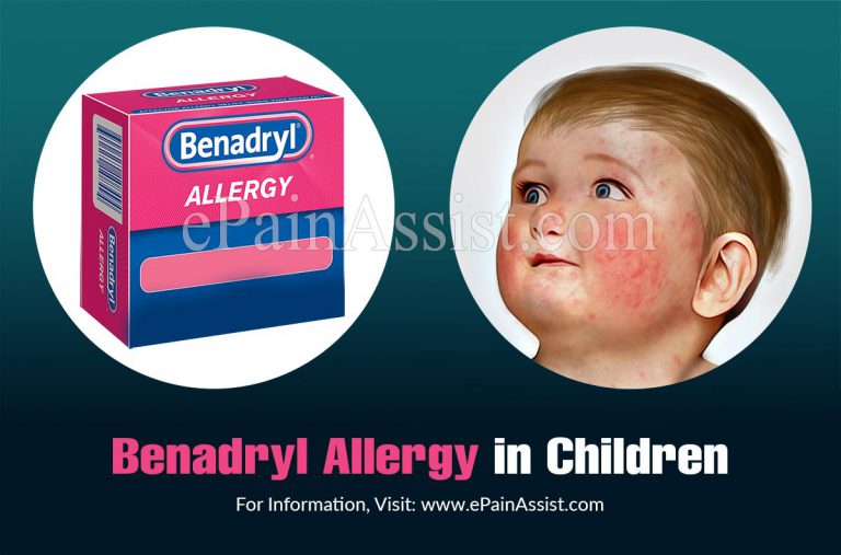 Benadryl Allergy & Its Treatment