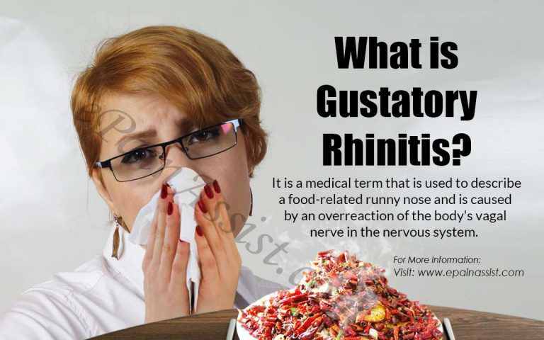 Gustatory Rhinitis: Causes, Symptoms, Treatment and Prevention of Runny Nose When Eating