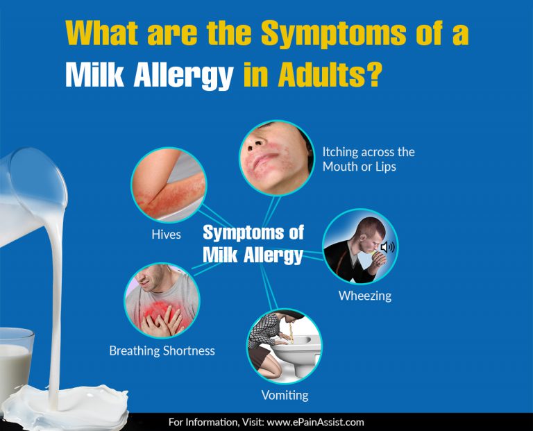 What Are The Symptoms Of A Milk Allergy In Adults?
