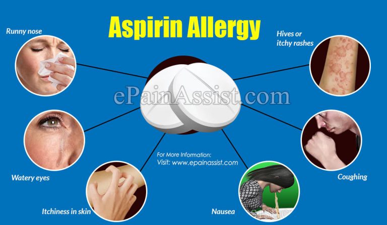 Aspirin Allergy: Symptoms & Management
