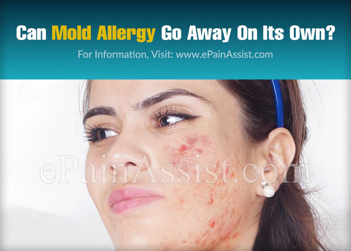 Do allergy symptoms go away on their own