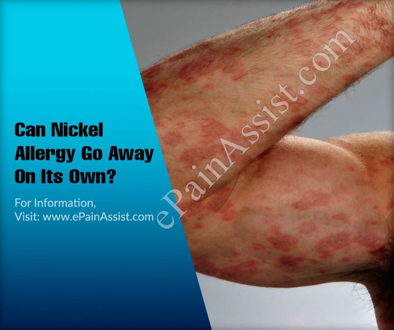 Can Nickel Allergy Go Away On Its Own & What Are It’s Natural Remedies?