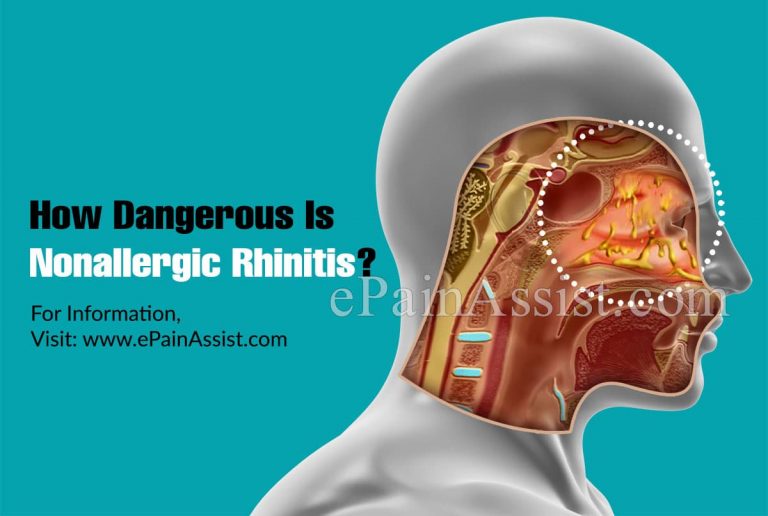 How Dangerous Is Nonallergic Rhinitis & Is It Contagious?