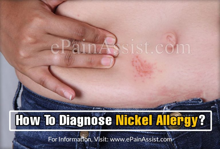 How To Diagnose Nickel Allergy & What Is The Best Medicine For It?