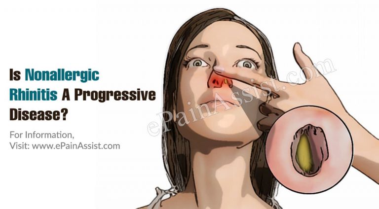 Is Nonallergic Rhinitis A Progressive Disease & Alternative Treatments For It?