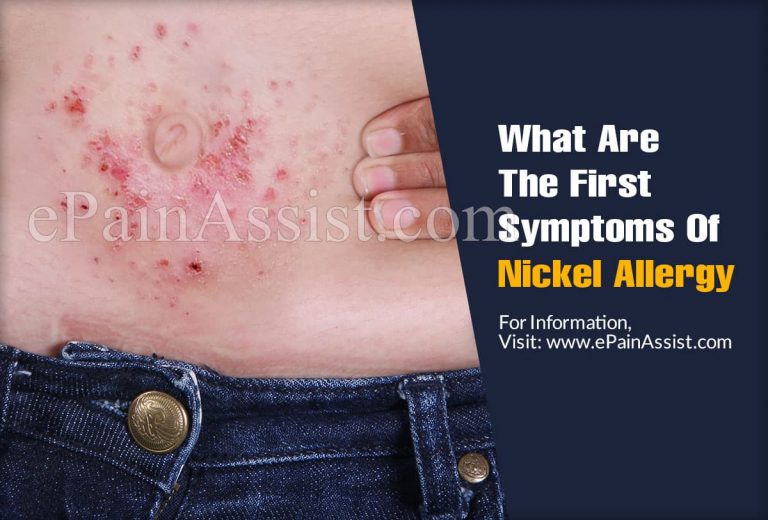 What Are The First Symptoms Of Nickel Allergy & How Do You Test For It?