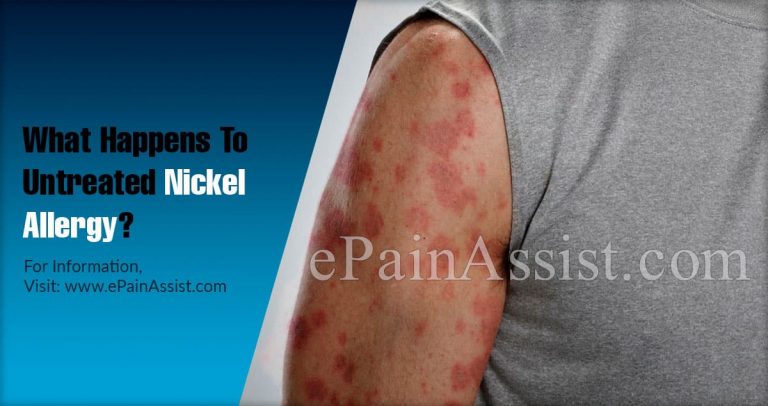 What Happens to Untreated Nickel Allergy & When To Go To Doctor?