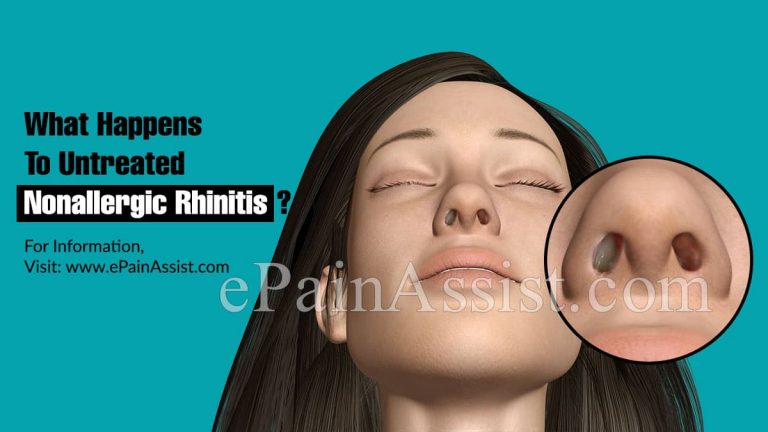 What Happens To Untreated Non-Allergic Rhinitis & When To Go To Doctor?