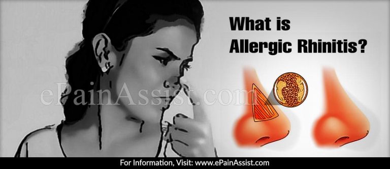 What is Allergic Rhinitis: Causes, Types, Symptoms, Treatment