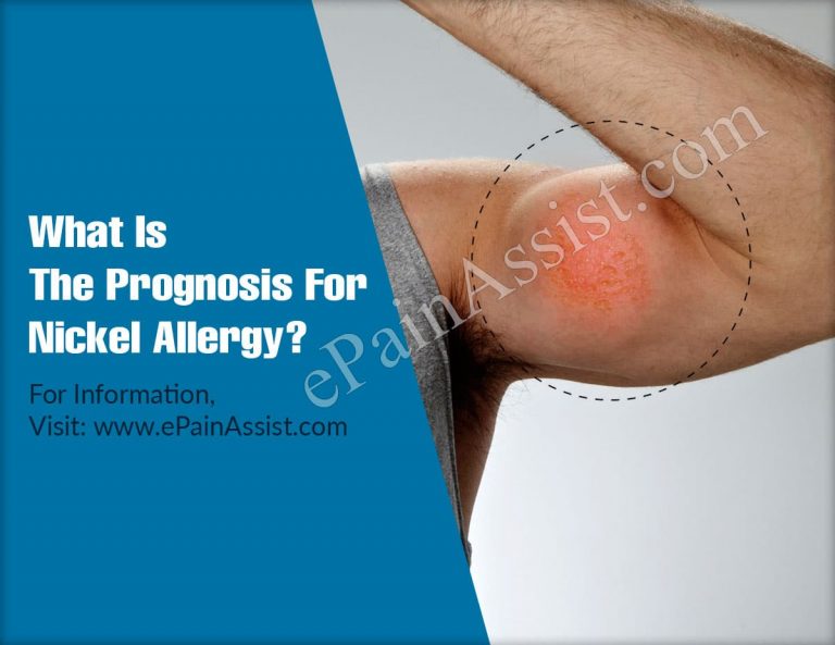 What Is The Prognosis For Nickel Allergy & Lifestyle Changes For It