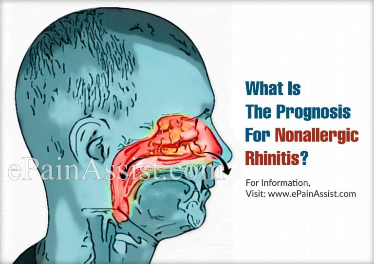 What Is The Prognosis For Nonallergic Rhinitis & Home Remedies For It?