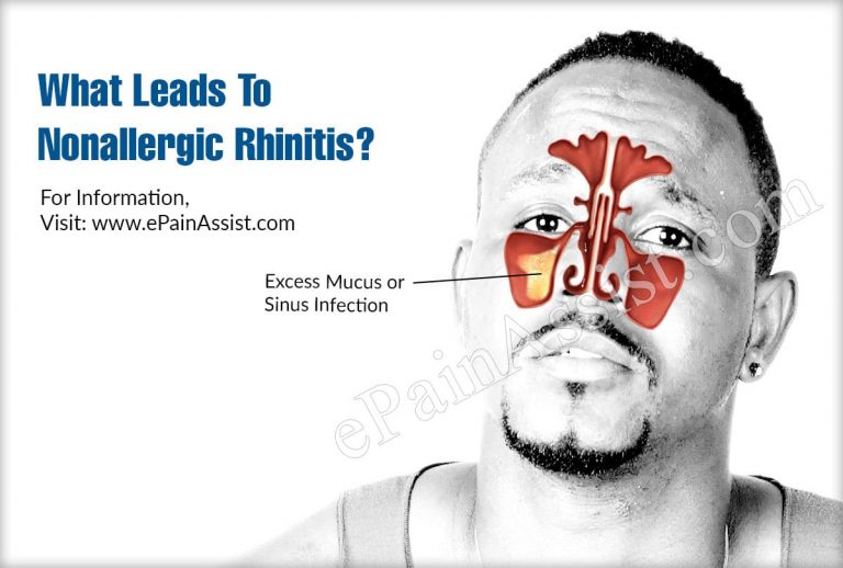 What Leads To Nonallergic Rhinitis & Can It Be Cured?