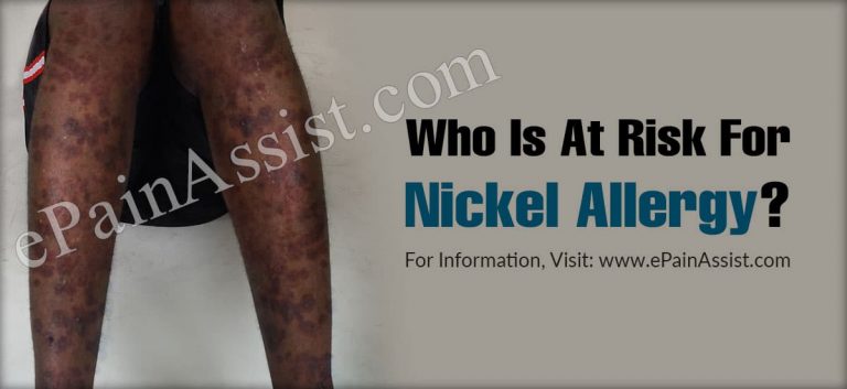 Who Is At Risk For Nickel Allergy & Is There A Blood Test For It?