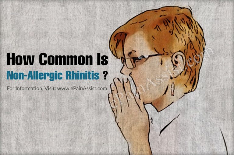How Common Is Non-Allergic Rhinitis Or Is It A Rare Disease?