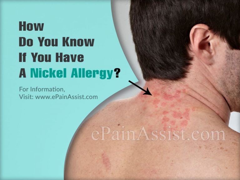 How Do You Know If You Are Allergic To Nickel & What Does Nickel Rash Look Like?