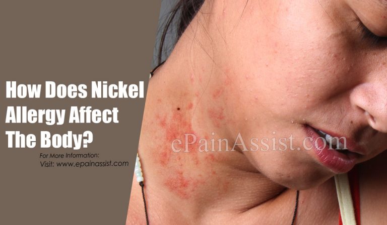 How Does Nickel Allergy Affect The Body & What Triggers It?