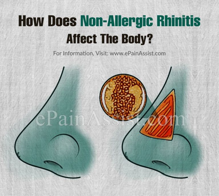How Does Non-Allergic Rhinitis Affect The Body & What Triggers It?