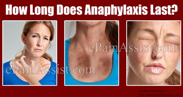 How Long Does Anaphylaxis Last?