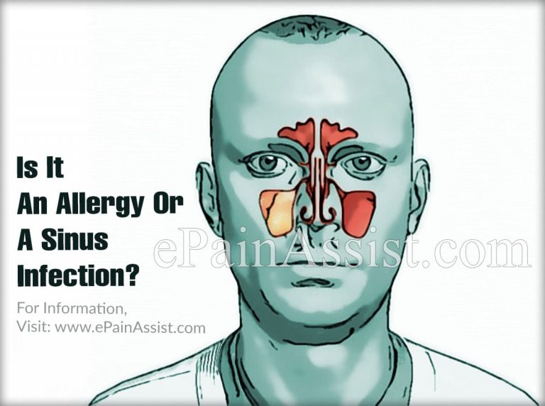 Is It An Allergy Or A Sinus Infection?