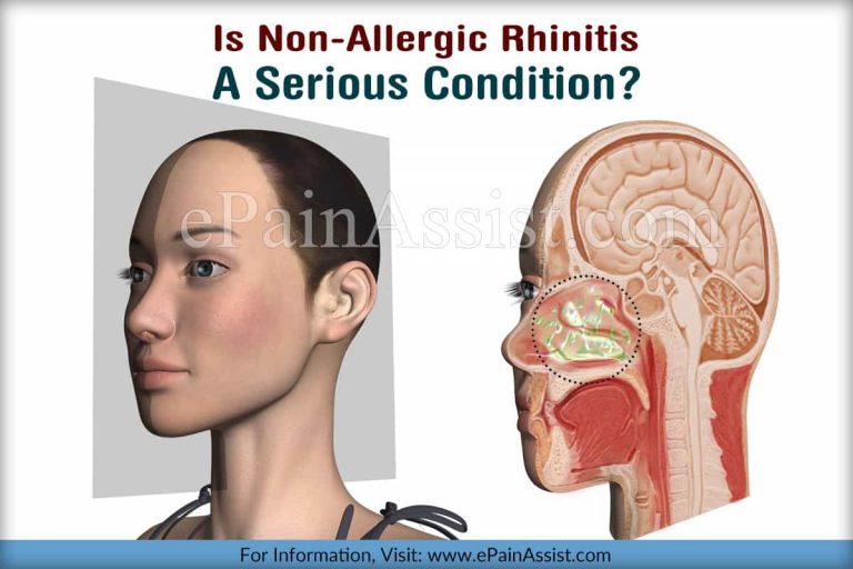 Is Non-Allergic Rhinitis A Serious Condition & Can It Be Reversed?