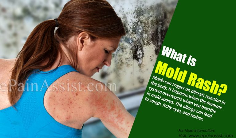 What is Mold Rash & How is it Treated?|Symptoms, Risk Factors, Diagnosis of Mold Rash