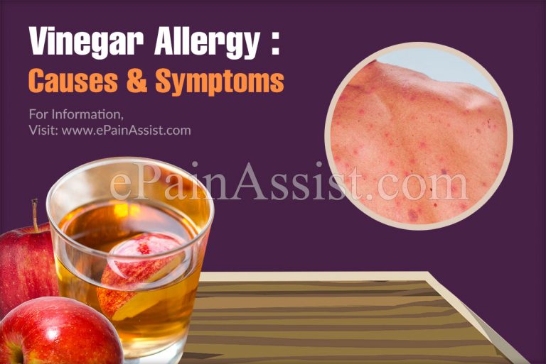 Vinegar Allergy: Causes & Symptoms