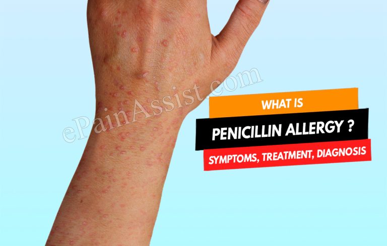 Penicillin Allergy: Types, Symptoms, Treatment, Diagnosis and Prevention