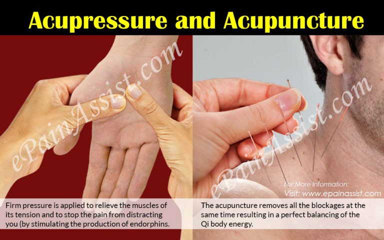 Acupressure and Acupuncture: How it Works, Its Effectiveness, Ailments It Can Treat