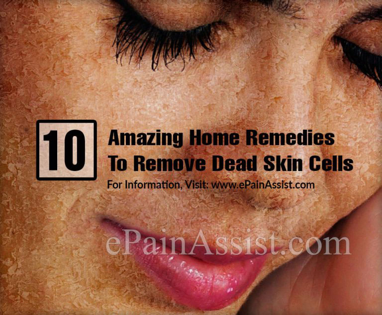 10 Amazing Home Remedies To Remove Dead Skin Cells