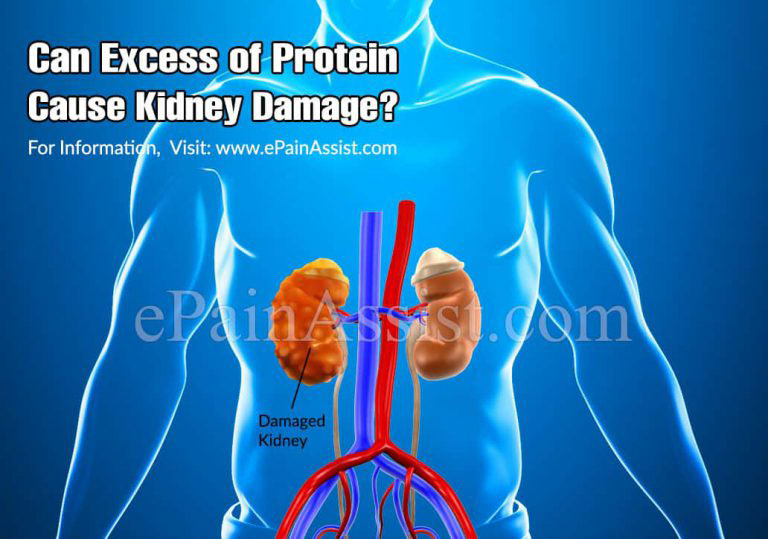 Can Excess of Protein Cause Kidney Damage?