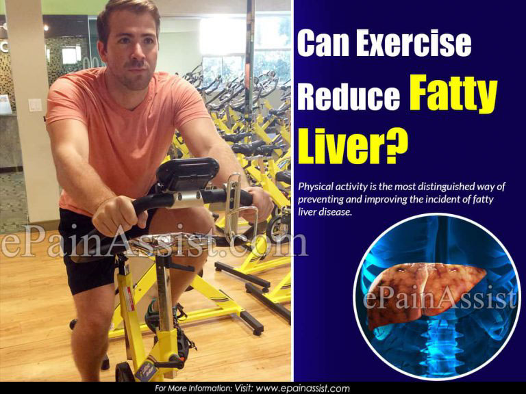 Can Exercise Reduce Fatty Liver?