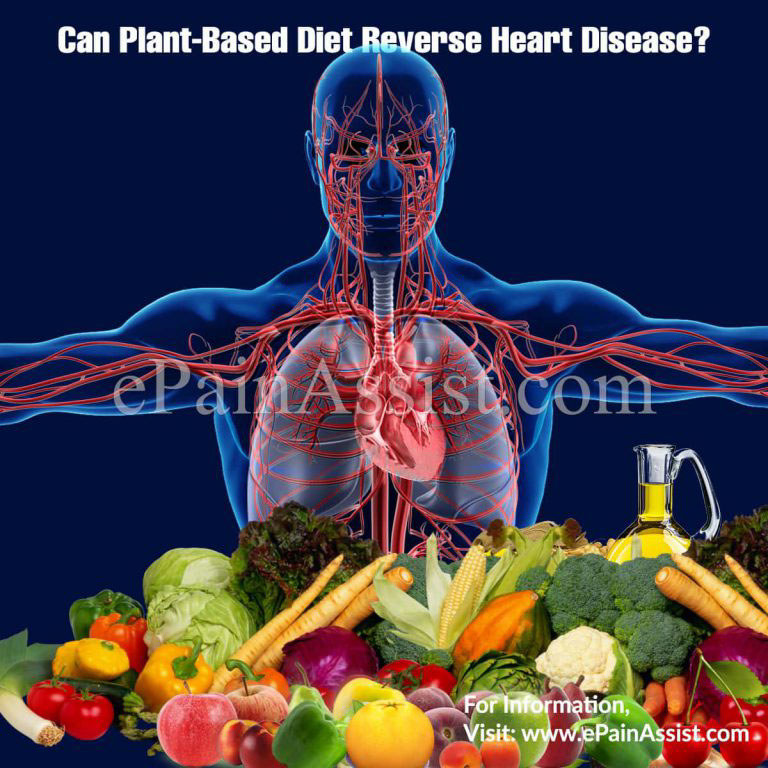 Can Plant-Based Diet Reverse Heart Disease?