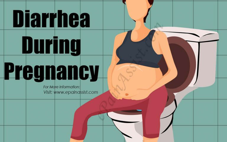 Diarrhea During Pregnancy: Causes, Treatment, Home Remedies to Deal With Diarrhea When Pregnant