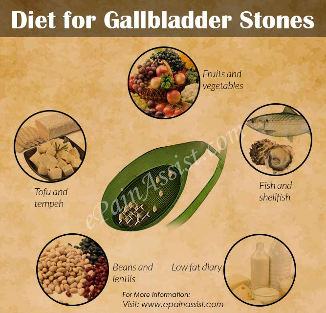 Gallstones Diet Chart