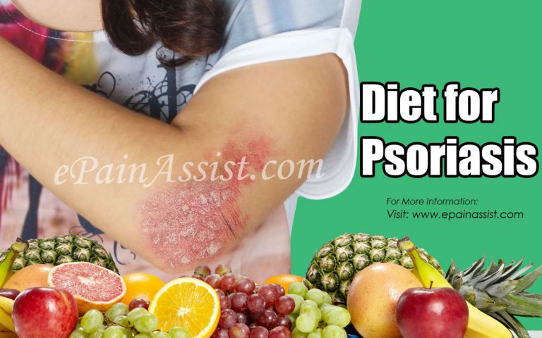 Diet for Psoriasis: Foods to Avoid & Foods to Include in Your Daily Diet for Psoriasis