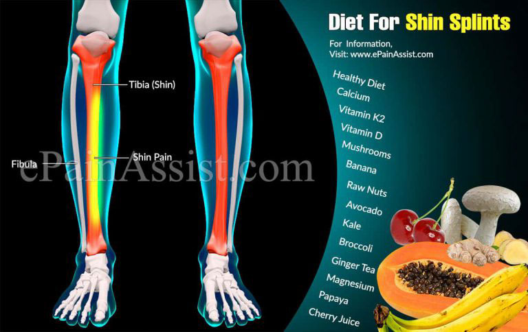 Diet For Shin Splints