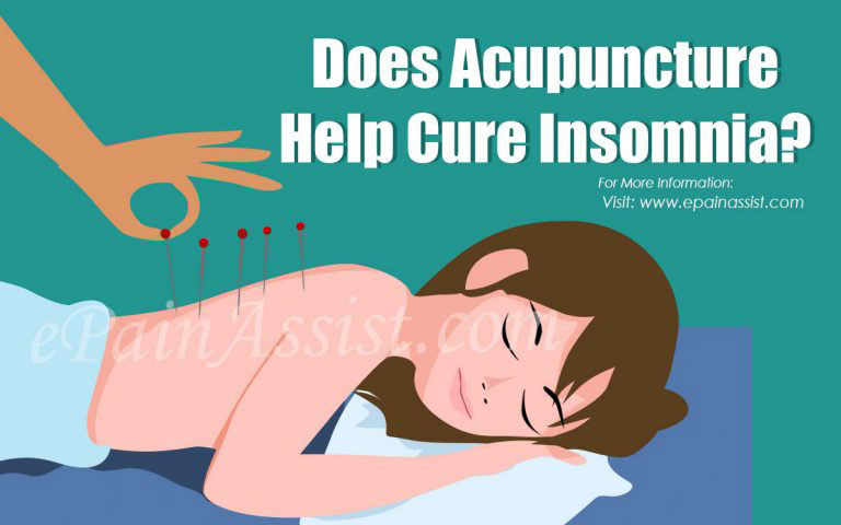 Does Acupuncture Help Cure Insomnia?