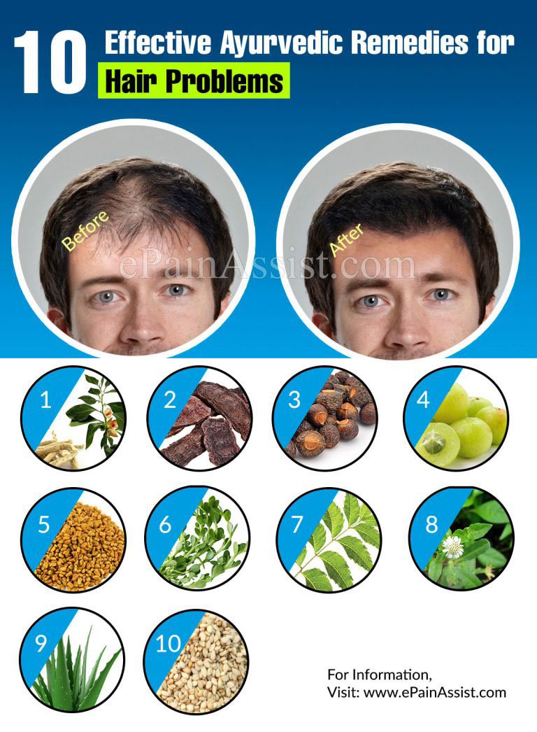 10 Effective Ayurvedic Remedies for Hair Problems