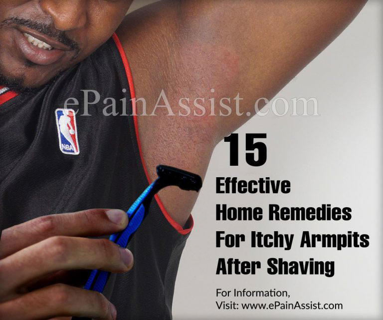 15 Effective Home Remedies For Itchy Armpits After Shaving