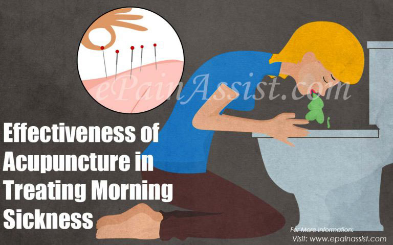 Effectiveness of Acupuncture in Treating Morning Sickness