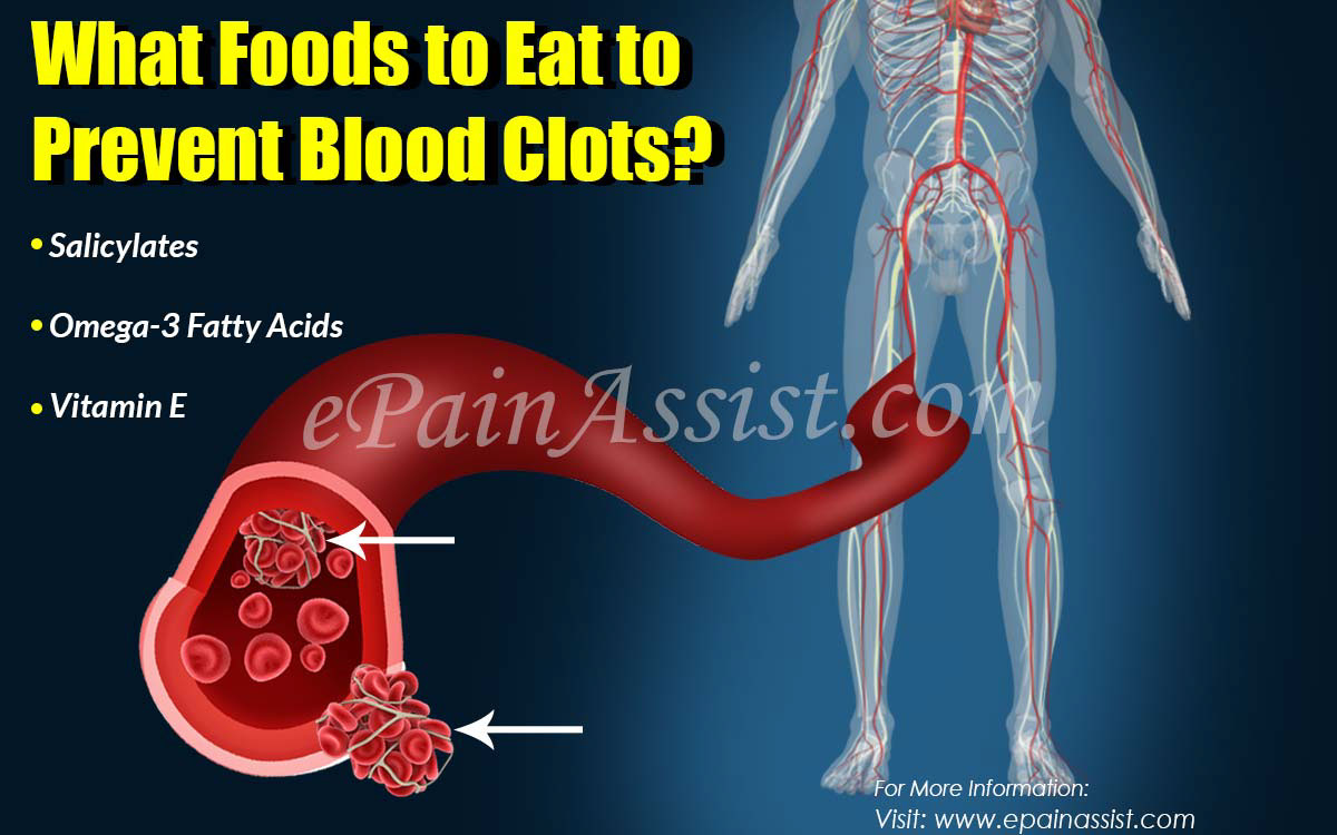 What Foods to Eat to Prevent Blood Clots?