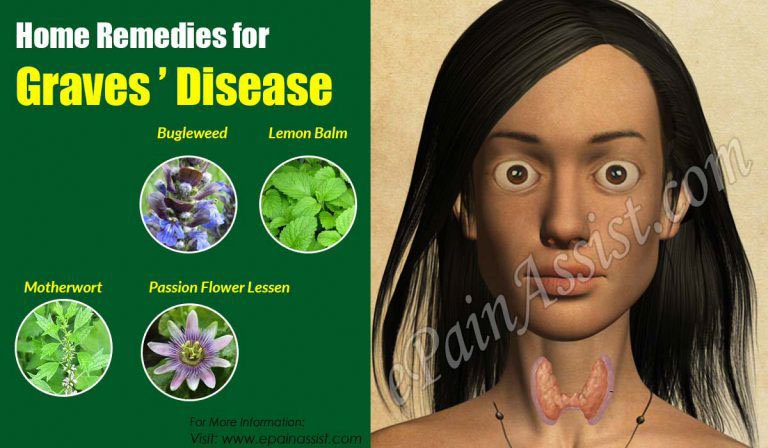 Home Remedies for Graves’ Disease
