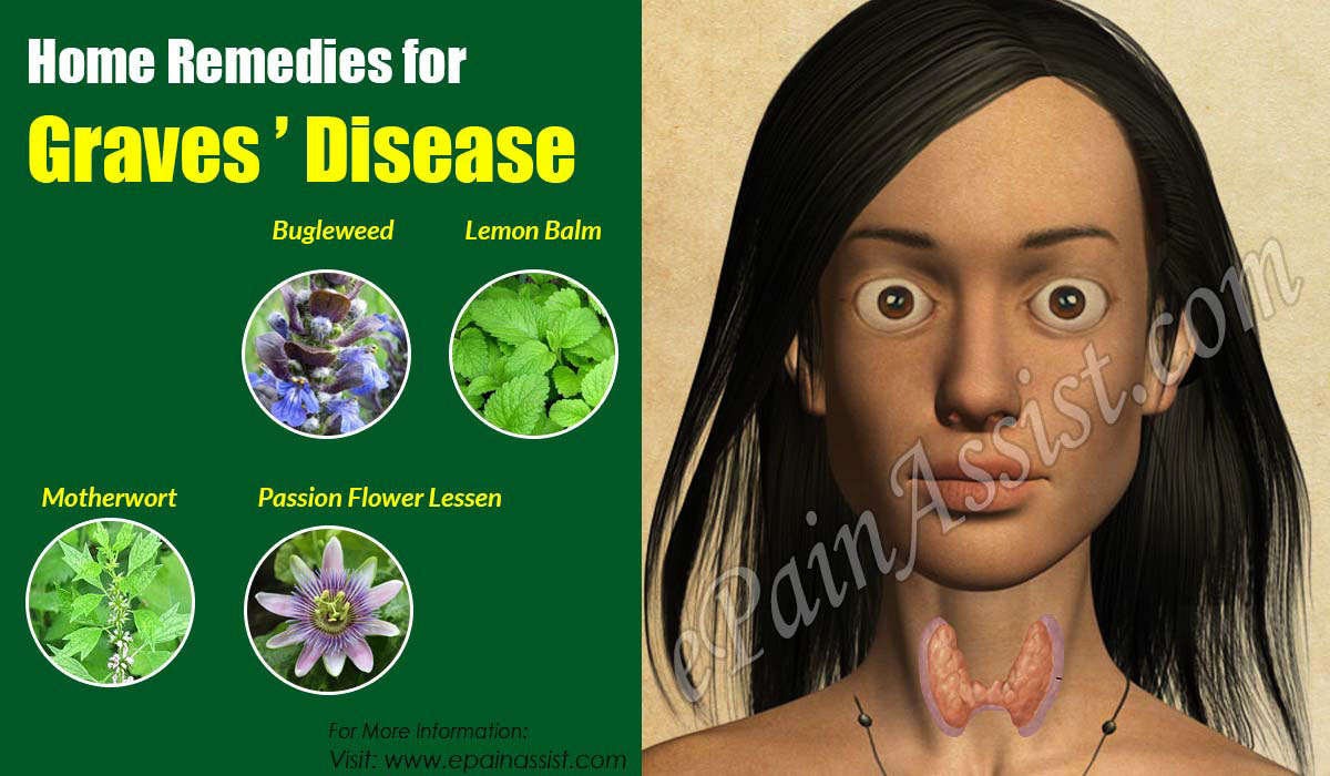 Home Remedies for Graves' Disease