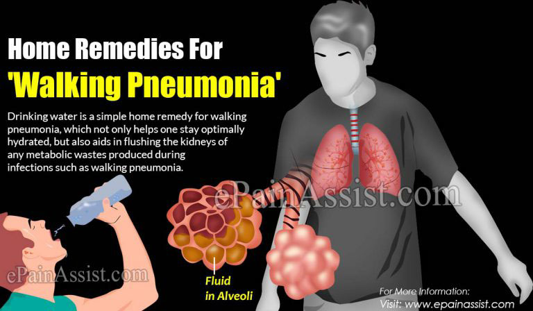 Home Remedies For ‘Walking Pneumonia’