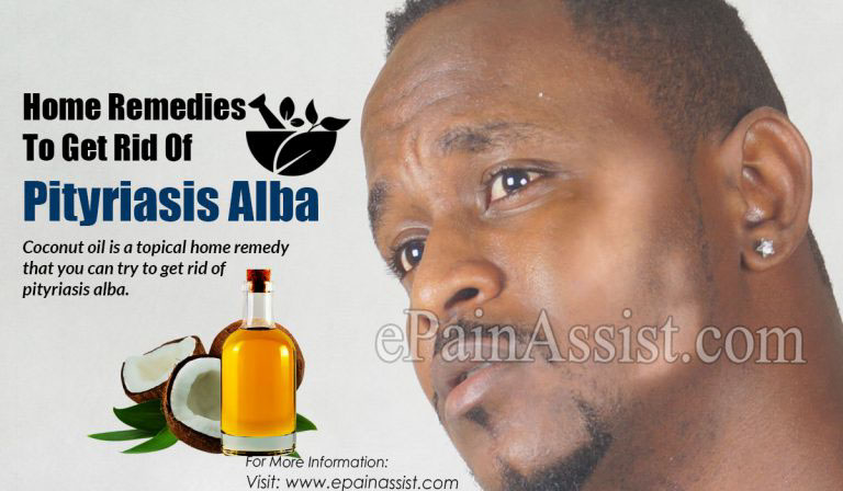 Home Remedies To Get Rid Of Pityriasis Alba: Topical, Dietary & Other Practices