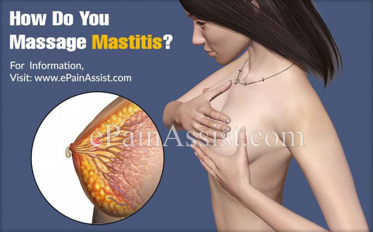 How Do You Massage Mastitis?