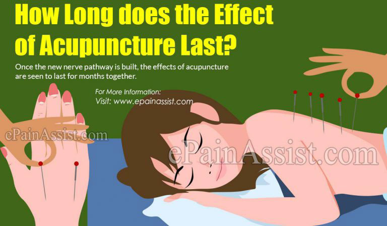 How Long Does the Effect of Acupuncture Last?